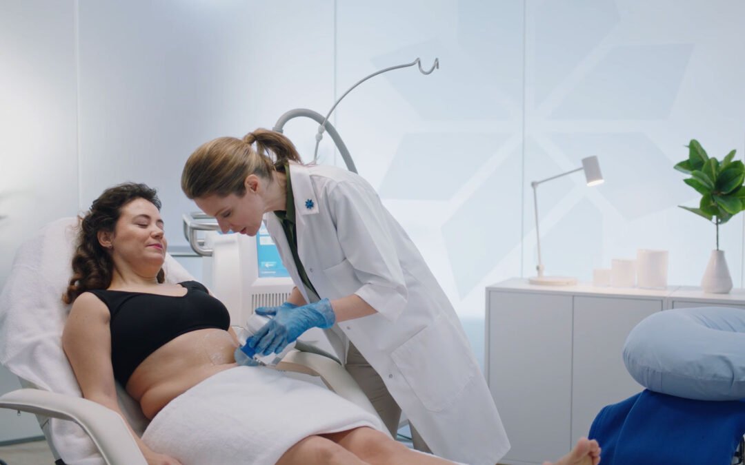 Coolsculpting: Surgery-free Shaping