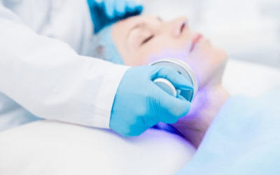 Advancements in Medical Grade Chemical Peel Technology