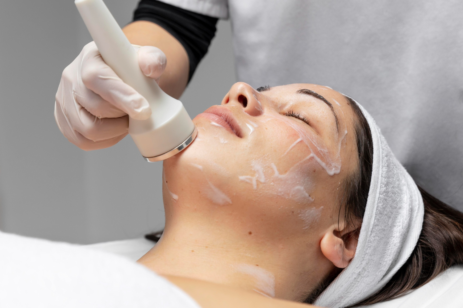 Chemical Peel Adelaide: Medical Grade Peels