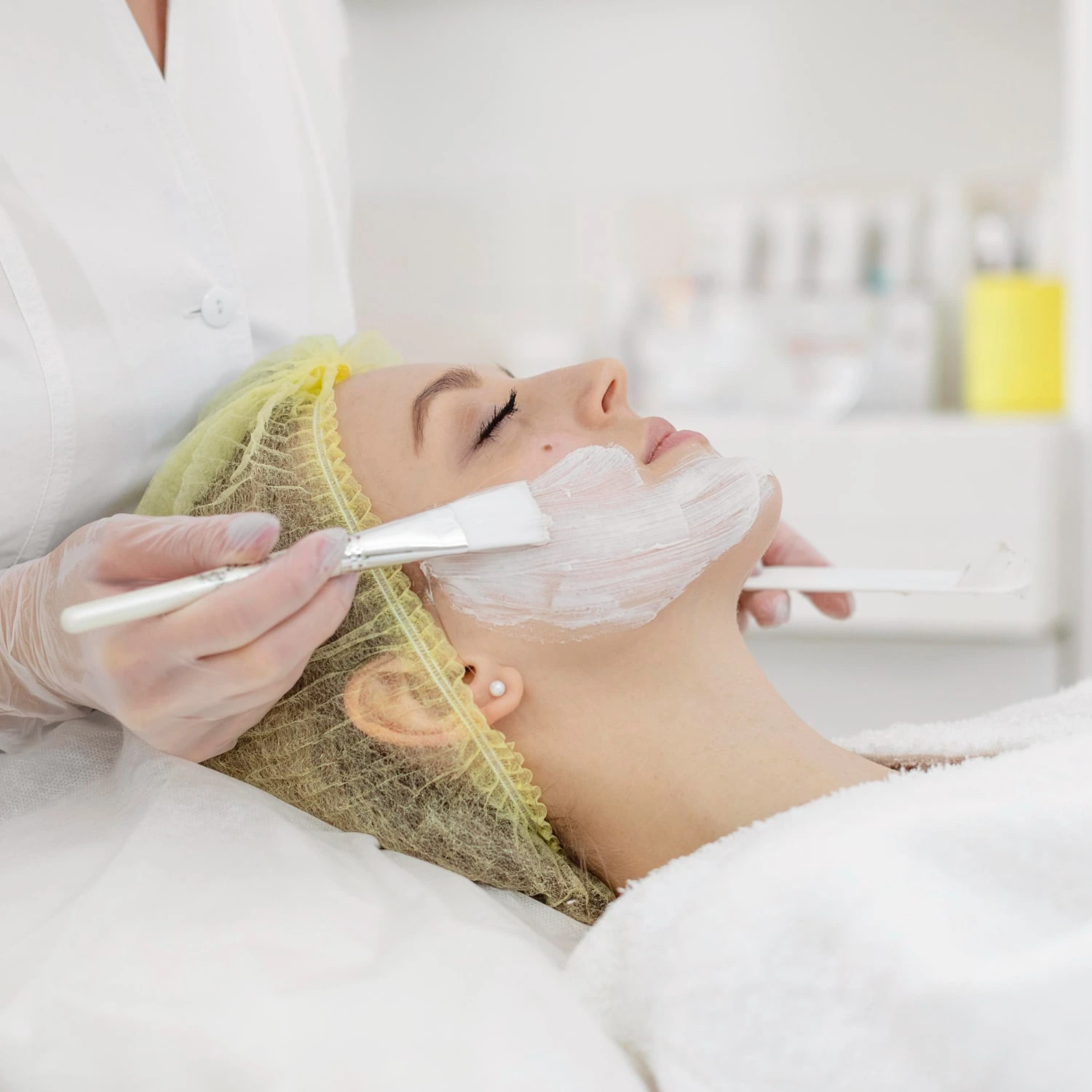 Chemical Peel Adelaide