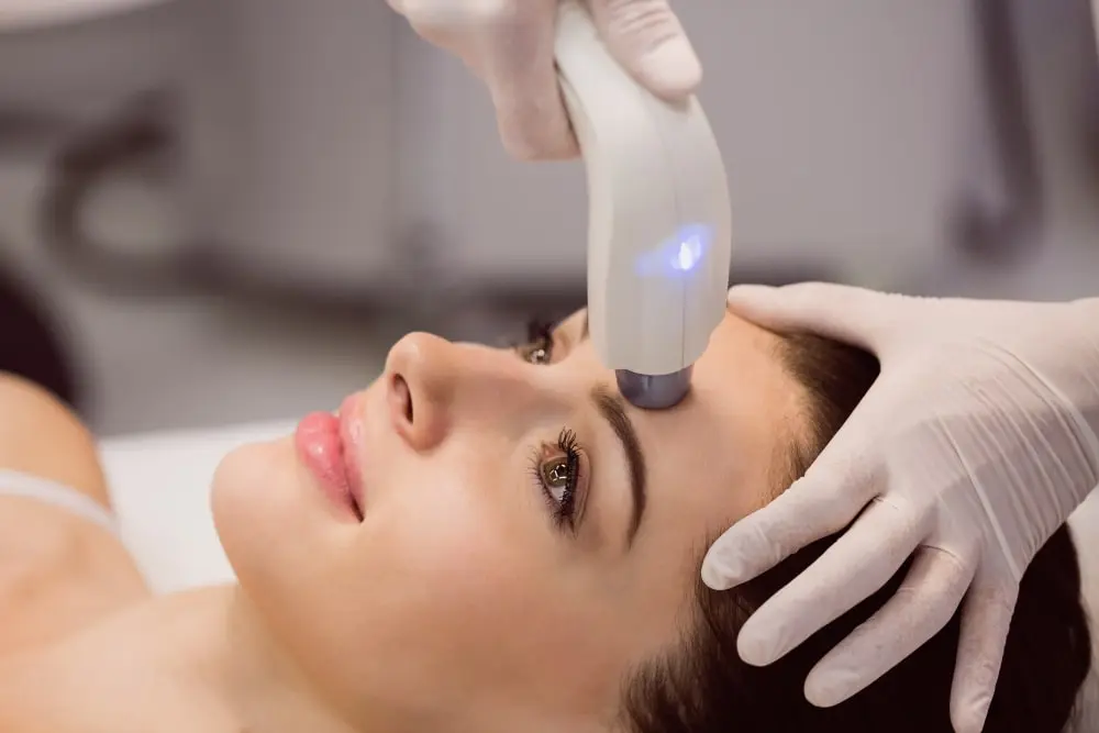 A client receiving CO2 Laser treatment in Adelaide